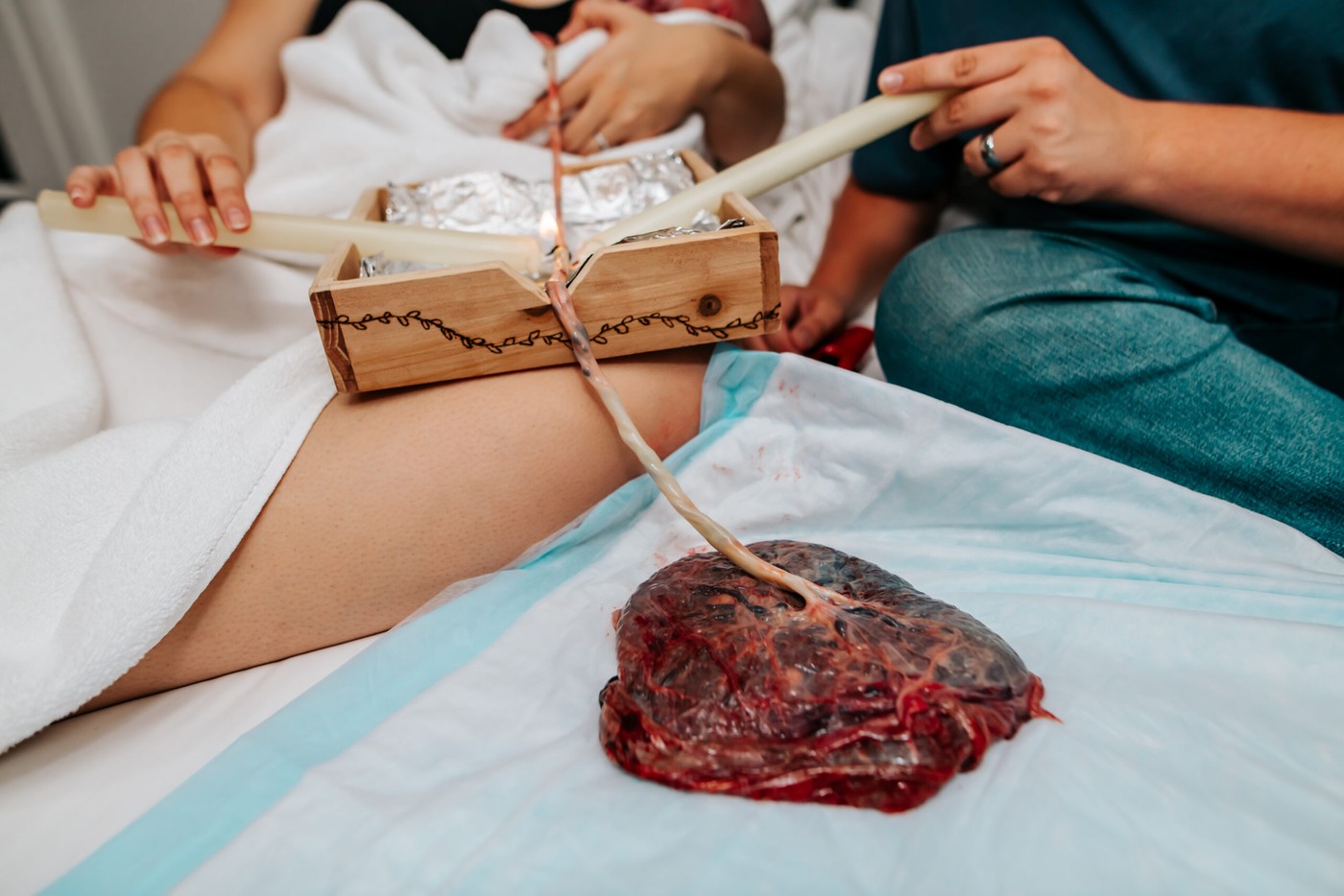 Placenta Encapsulation in Lubbock - Heartbeat Midwifery
